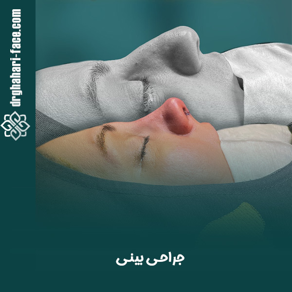 جراحی بینی - دکتر قهاری