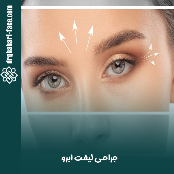 جراحی لیفت ابرو - دکتر حامد قهاری