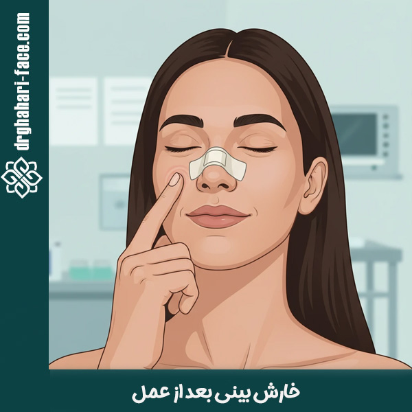 خارش بینی بعد از عمل - دکتر قهاری