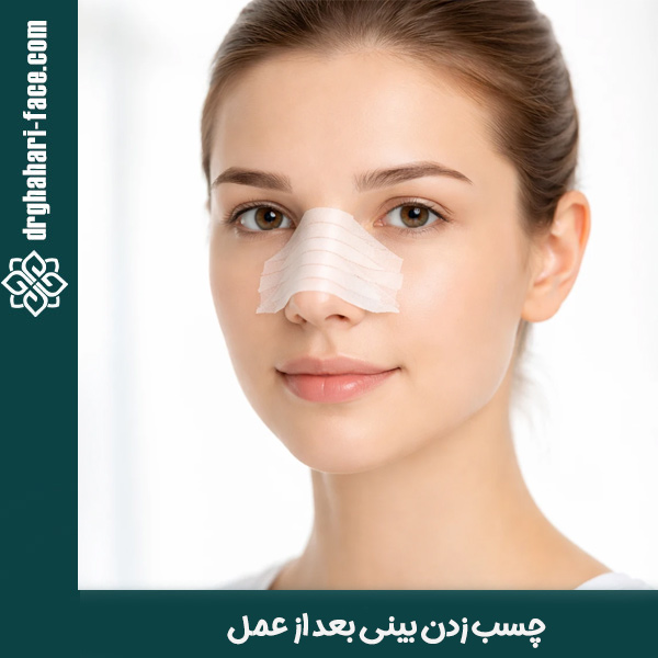 چسب زدن بینی بعد از عمل - دکتر قهاری