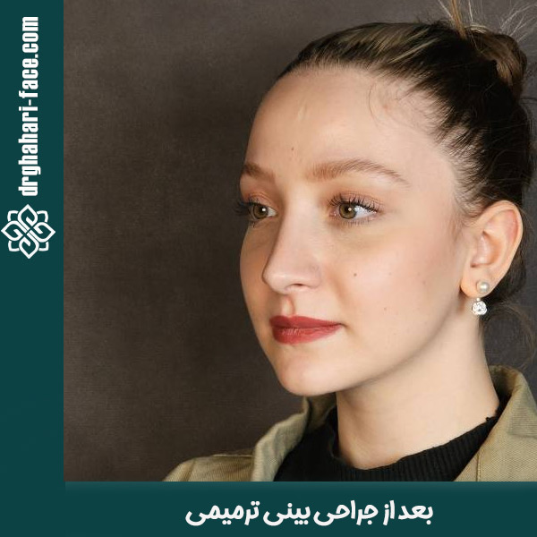 جراحی بینی ترمیمی - دکتر قهاری